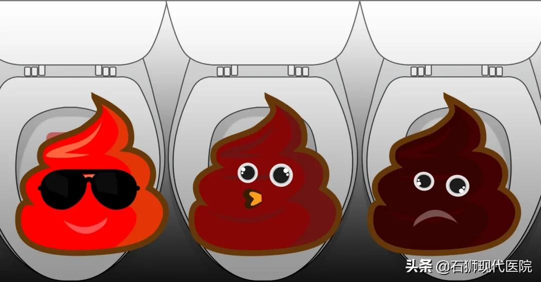 便血了可咋办!是痔疮还是癌?石狮肛肠外科专家教您“见色识病”