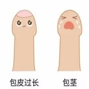 包皮过长对男性的健康有哪些影响？