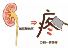 肾结石疼到满地打滚，牢记3要吃，专克